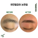 국민털잡이 슈가링 왁싱 논현점