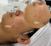 예손스킨앤바디