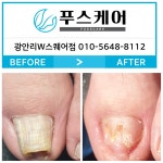 푸스케어 부산광안리W스퀘어점