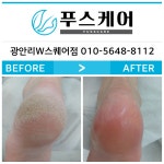 푸스케어 부산광안리W스퀘어점