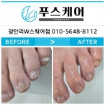 푸스케어 부산광안리W스퀘어점