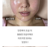 에스테라피  스킨케어