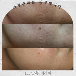 피부빛나다