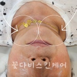 꽃다비스킨케어