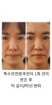 쑴숨쉬듯휴식하다&숲칼프