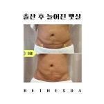 베데스다