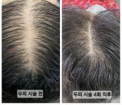 문브로우뷰티