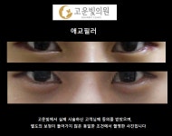 고운빛의원
