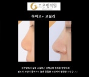 고운빛의원