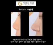 고운빛의원