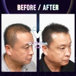 디비전스칼프 평택본점