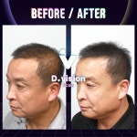 디비전스칼프 평택본점