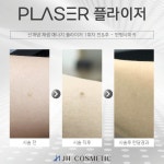더맑은스킨 경기광주태전점