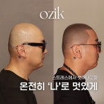 오직스칼프 울산본점