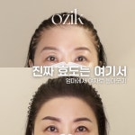 오직스칼프 울산본점