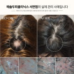 헤솔두피클리닉스 서면점