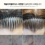헤솔두피클리닉스 서면점