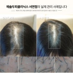 헤솔두피클리닉스 서면점