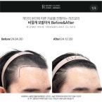 리즈모의원 대전