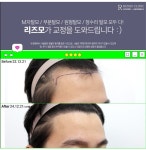 리즈모의원 대전