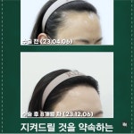 리즈모의원 대전