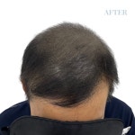 림스칼프 대구본점