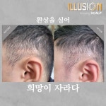 일루젼스칼프 안양