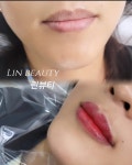 린뷰티