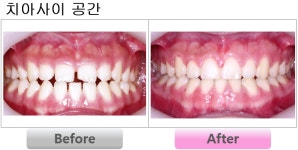 서울고운미소치과교정과치과의원