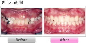 서울고운미소치과교정과치과의원
