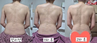 위더스산후케어민낯 | 위더스산후케어