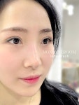 모노아이룸