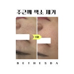 베데스다