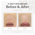인뷰티랩