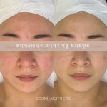 꼬미에스테틱 하남미사점