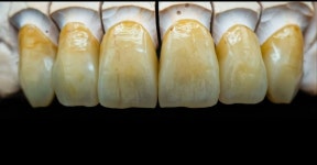지맥스치과기공소