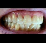 지맥스치과기공소