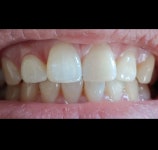 지맥스치과기공소