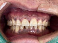 지맥스치과기공소