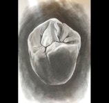 지맥스치과기공소