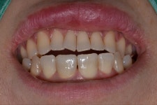 지맥스치과기공소