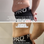 에스라인테라피 셀포랩아우름