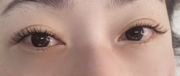 린뷰티