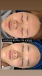에그뮤즈 스킨스칼프 수원직영점