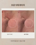 빛담스킨랩