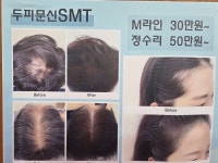 오정은헤어크리닉눈썹