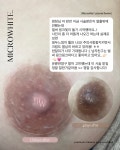 마이크로청담