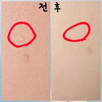 르네셀