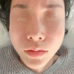 리봄 스킨앤바디