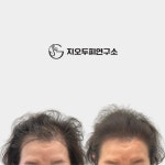 지오두피연구소